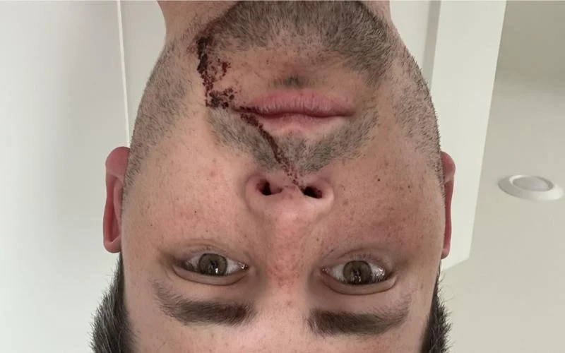 SPD investigating attack on journalist during Antifa protests