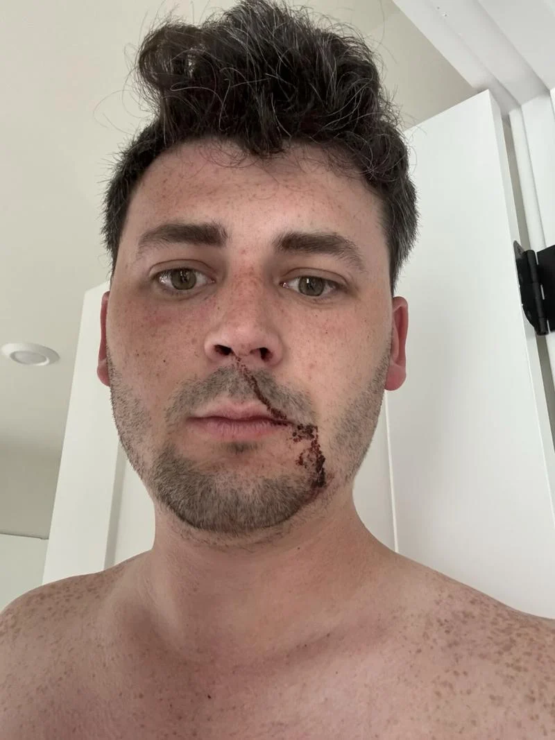 Seattle PD forwards felony assault charge to prosecutor 10 days after journalist attacked